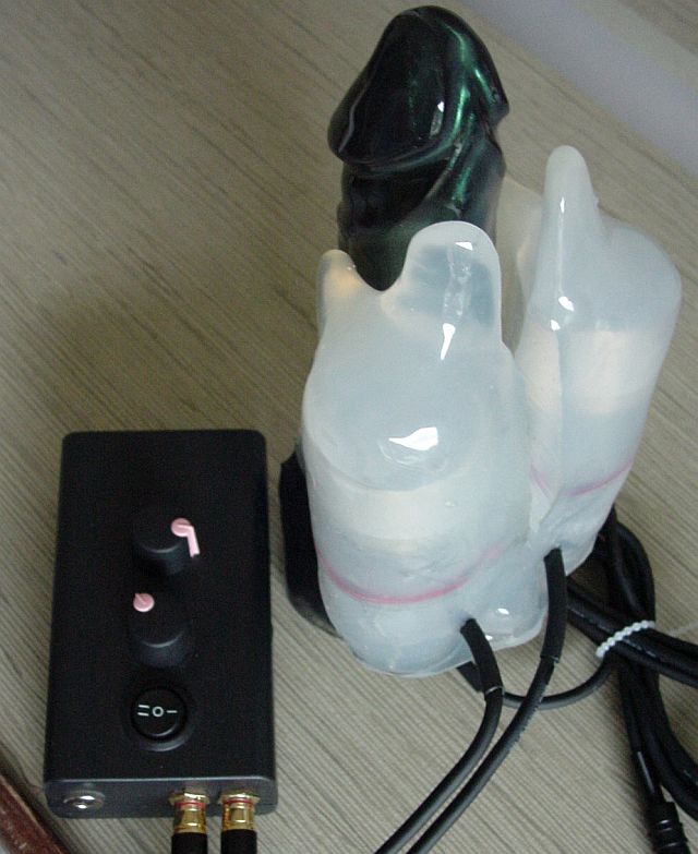 twincharger